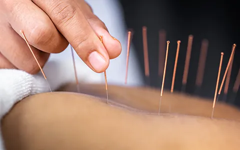 Acupuncture for Autism
