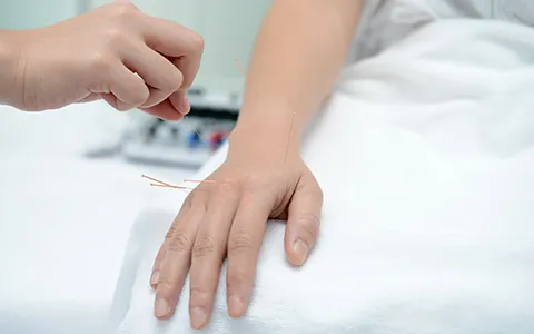 Pediatric Acupuncture